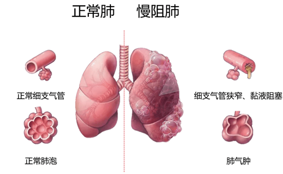 https://p4.itc.cn/images01/20231115/03083fa0dea344aab3435642ddef39c8.png